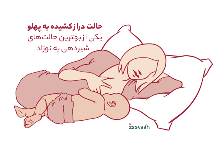 حالت شیردهی دراز کشیده به پهلو (Side-Lying)